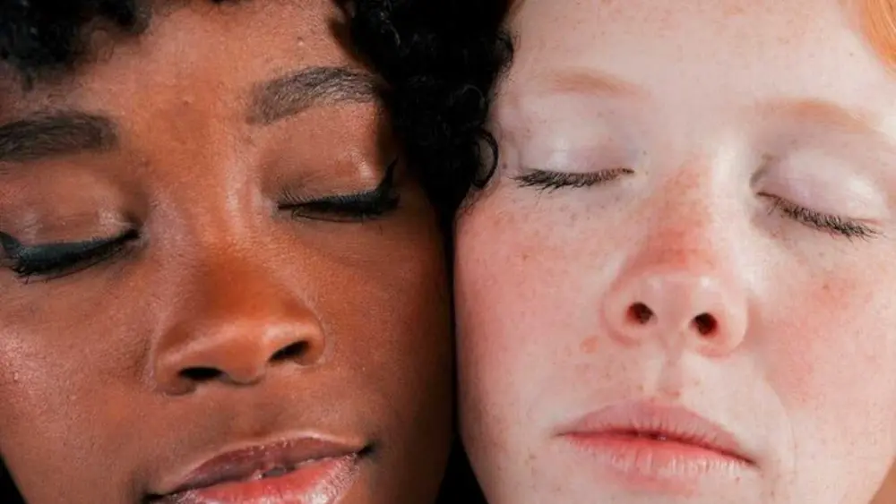 Quais são os 3 tipos de melasma